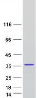 Human CCDC124 Protein (Recombinant Myc-DDK (Flag))