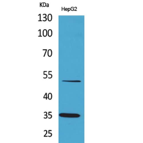 Polyclonal Rabbit anti-Human TFPI / LACI Antibody (C-terminal, WB)