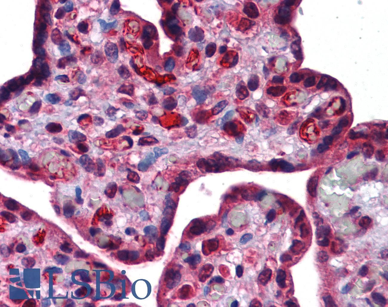 Polyclonal Rabbit anti-Human DLX6 Antibody (aa36-85, IHC, WB)
