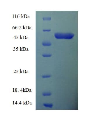 Mouse Serpina3n Protein (Recombinant His-SUMO)