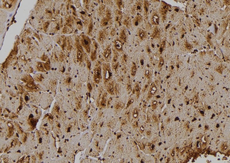 STK33 Antibody