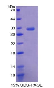 Human ROCK2 Protein (Recombinant His-T7)