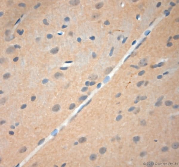 NGF Antibody (aa130-180)