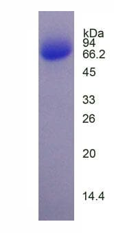 Human NR2E3 / PNR Protein (Recombinant His-GST)