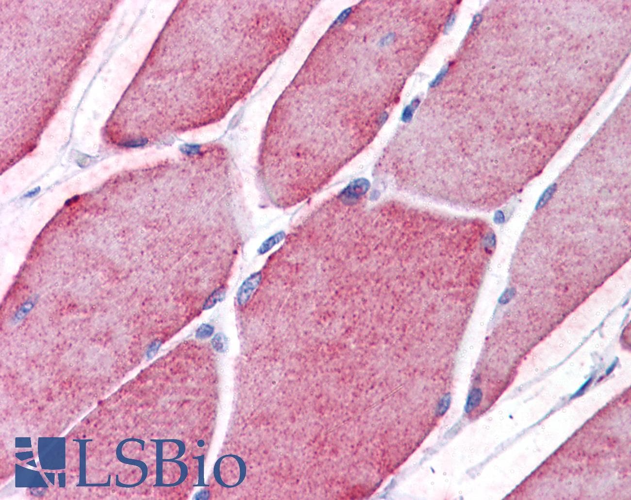 IHC-plus™ Polyclonal Rabbit anti-Human TCTN2 Antibody (IHC, WB)