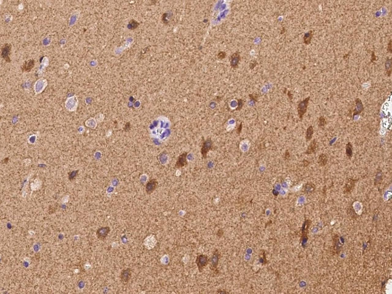 Polyclonal Rabbit anti-Human TMEM132A / HSPA5BP1 Antibody (IHC)