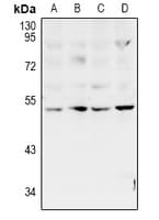 PLAGL1 / ZAC Antibody