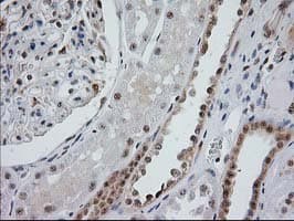 Monoclonal Mouse anti-Human MGLL / Monoacylglycerol Lipase Antibody (clone OTI1H1, IHC, IF, WB)