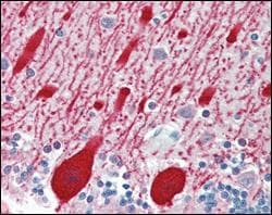 AMACR / P504S Antibody (clone 2A10F3)