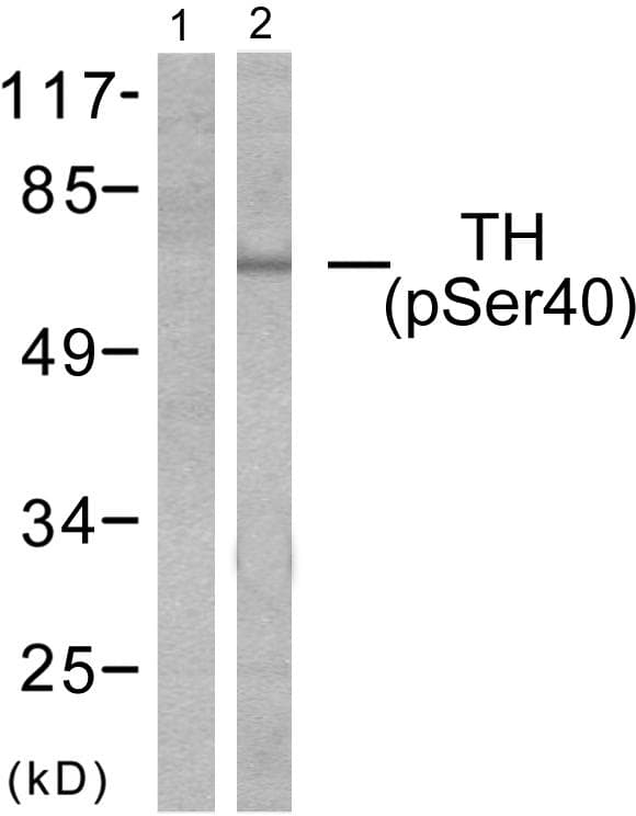TH / Tyrosine Hydroxylase Antibody (phospho-Ser40)