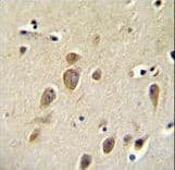 Polyclonal Rabbit anti-Human RARS Antibody (aa605-634, IHC, IF, WB)