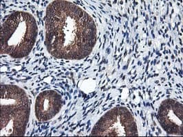 ALS2CR1 / NIF3L1 Antibody (clone OTI4B5)