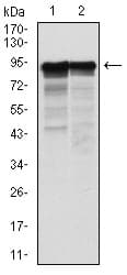 Monoclonal Mouse anti-Human NF-L / NEFL Antibody (clone 2G10, IHC, IF, WB)
