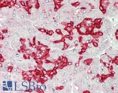 Sialylated Lewis a / CA 19-9 Antibody