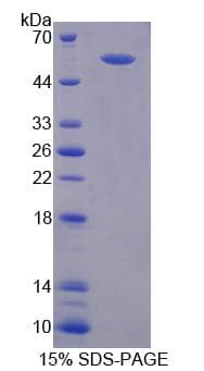 Rat RGS6 Protein (Recombinant His-T7)