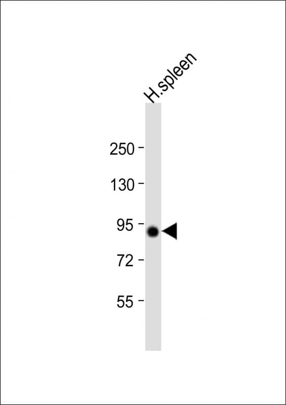 VAC14 / TRX Antibody (aa125-159)