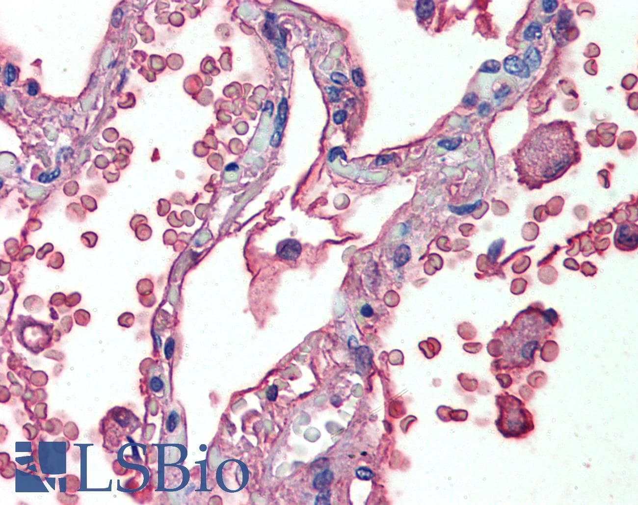 IHC-plus™ ALB / Serum Albumin Antibody (clone 8F6F9)