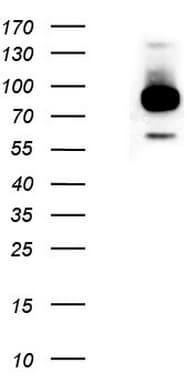 GPR49 / LGR5 Antibody (aa22-543, clone UMAB211)