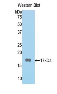 POSTN / Periostin Antibody (aa500-630)