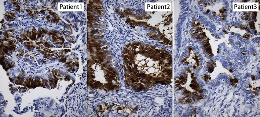 Monoclonal Mouse anti-Human NR5A1 / SF1 Antibody (clone OTI10E2, aa1-262, IHC)