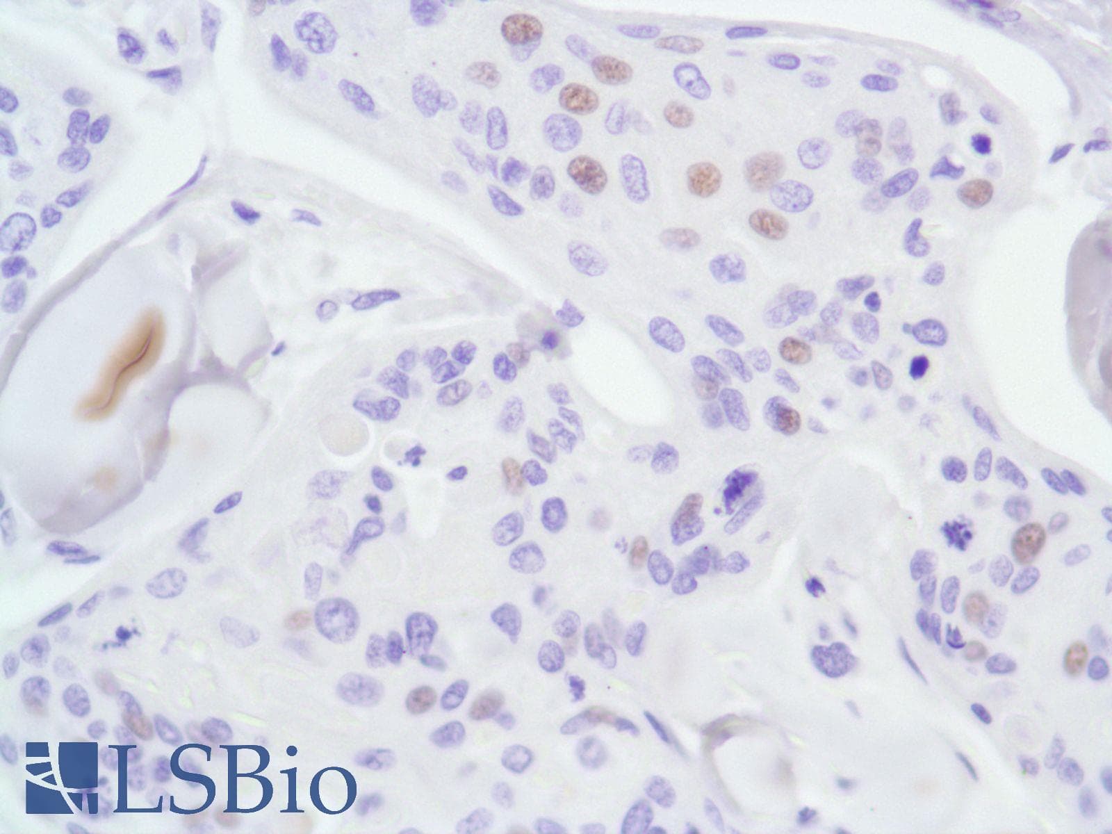 Monoclonal Rabbit anti-Human AR / Androgen Receptor Antibody (clone SP107, N-Terminus, IHC)