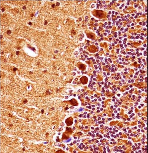MAPK9 / JNK2 Antibody (aa206-233)