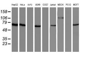 Monoclonal Mouse anti-Human NUB1 Antibody (clone OTI2G1, IHC, WB)