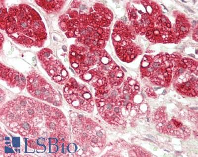 IHC-plus™ PGR1 / GPR153 Antibody (Internal)