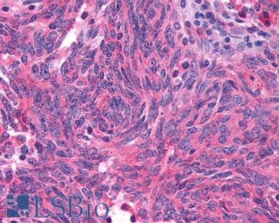 PathPlus™ Polyclonal Rabbit anti-Human GLP1R / GLP-1 Receptor Antibody (N-Terminus, IHC)