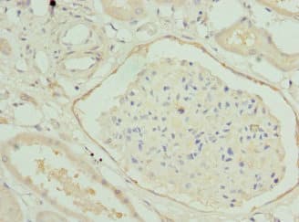 HGD Antibody