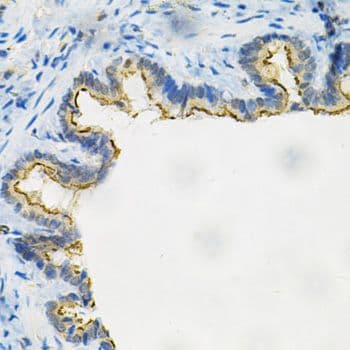 AKR1B1 / Aldose Reductase Antibody