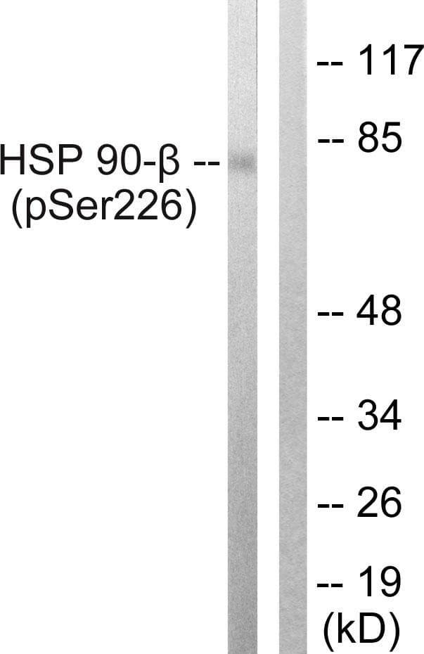 Polyclonal Rabbit anti-Human HSP90AB1 / HSP90 Alpha B1 Antibody (phospho-Ser226, IF, WB)