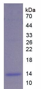 Rat UCP2 Protein (Recombinant His)
