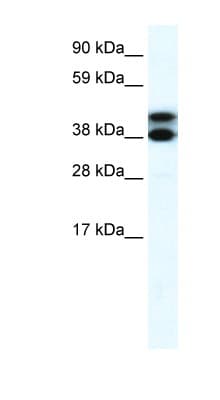 TRIM13 Antibody (aa165-214)