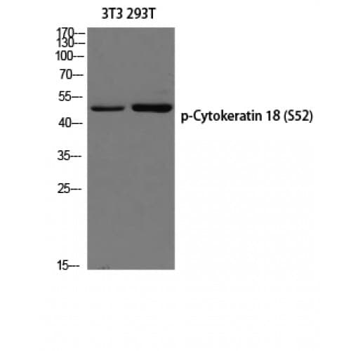 KRT18 / CK18 / Cytokeratin 18 Antibody (40-120 aa)