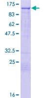 Human L3MBTL3 Protein (Recombinant GST)