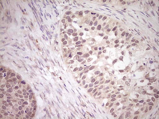 LPIN1 / Lipin 1 Antibody (aa1-274, clone OTI4C11)