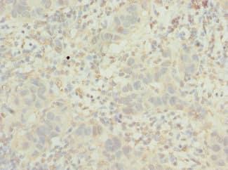 POC1B / WDR51B Antibody