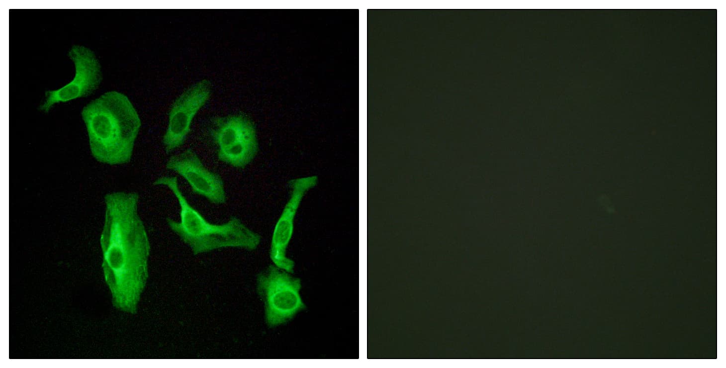 ADGRD1 / GPR133 Antibody (aa461-510)