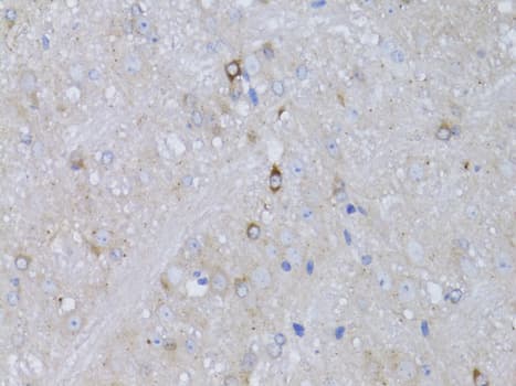 Polyclonal Rabbit anti-Human RARA / RAR Alpha Antibody (IHC, WB)