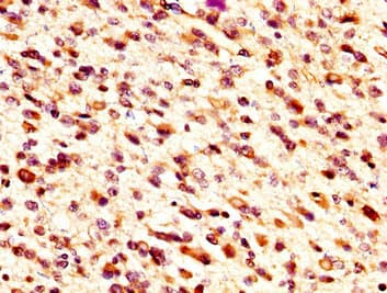 Polyclonal Rabbit anti-Human MID1IP1 Antibody (IHC)