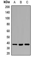 Polyclonal Rabbit anti-Human RBM22 Antibody (WB)
