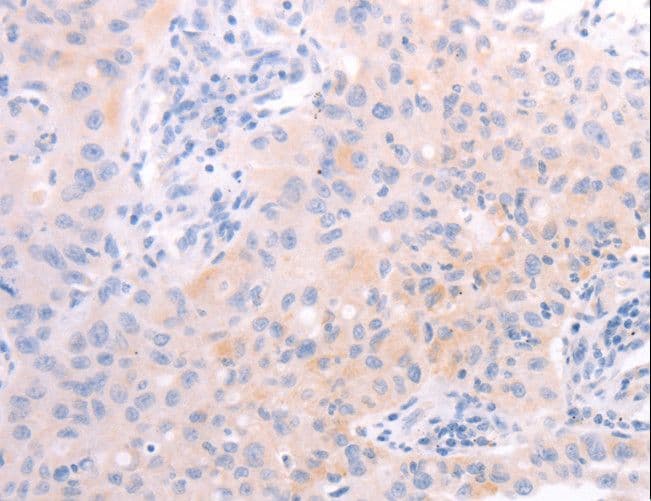 AMH / Anti-Mullerian Hormone Antibody