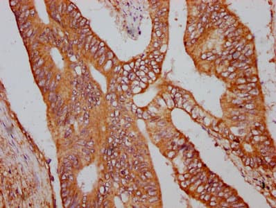UBR3 Antibody