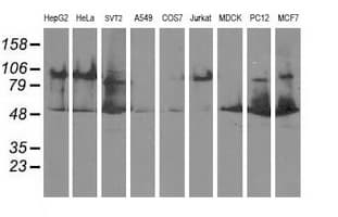 DLD / Diaphorase / E3 Antibody (clone OTI5G7)