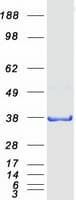 Human QKI Protein (Recombinant Myc-DDK (Flag))