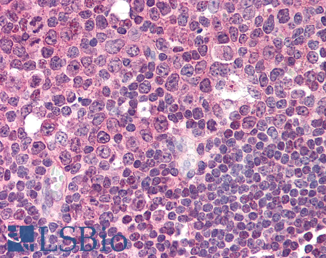 IHC-plus™ LAT2 / NTAL Antibody (aa196-212, clone NAP-03)