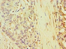 TARBP2 / TRBP2 Antibody (aa1-366)