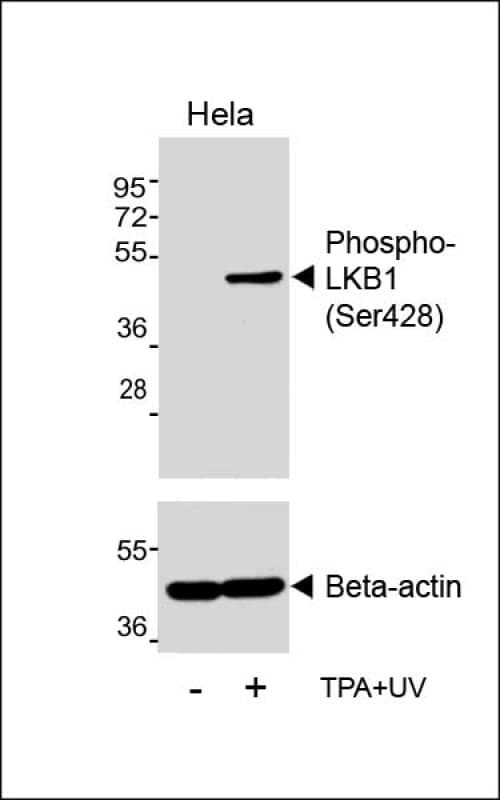 STK11 / LKB1 Antibody (phospho-Ser428)