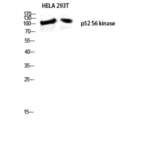 Polyclonal Rabbit anti-Human RPS6KC1 Antibody (200-280 aa, Internal, IF, WB)